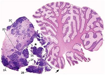 Case report: Infratentorial Embryonal Tumor with Abundant Neuropil and True Rosettes (ETANTR) in an 8-month-old Maine Coon